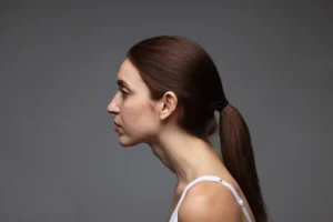 ストレートネックの女性